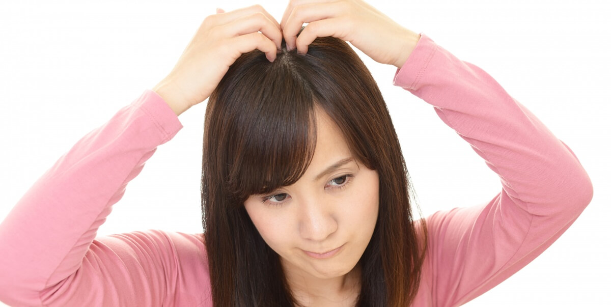 薄毛が気になる女性（30代40代）